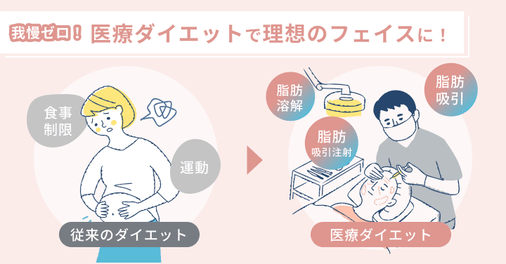 我慢ゼロ！医療ダイエットで理想のフェイスに！