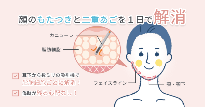 顔のもたつきと二重あごを1日で解消